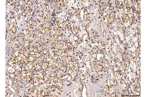 IHC analysis of Sorbitol Dehydrogenase/SORD using anti-Sorbitol Dehydrogenase/SORD antibody (ABIN7602485). (SORD 抗体  (AA 8-357))