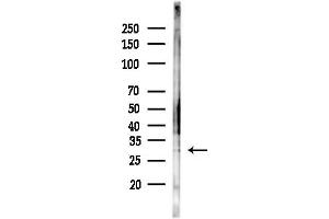 anti-Proline Rich Gla (G-Carboxyglutamic Acid) 4 (Transmembrane) (PRRG4) (Internal Region) antibody