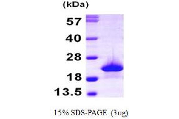 MYO3B Protein (AA 1-154) (His tag)