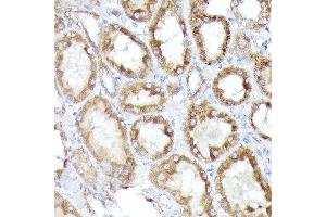 Immunohistochemistry of paraffin-embedded rat kidney using BNIP3L Rabbit pAb (ABIN6129989, ABIN6137622, ABIN6137623 and ABIN6221881) at dilution of 1:100 (40x lens).