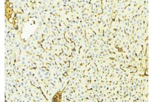 ABIN6269022 at 1/100 staining Mouse liver tissue by IHC-P. (VDAC1 抗体  (C-Term))