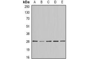 Western blot analysis of BAP29 expression in SKOV3 (A), MCF7 (B), mouse testis (C), mouse brain (D), rat heart (E) whole cell lysates. (BCAP29 抗体)