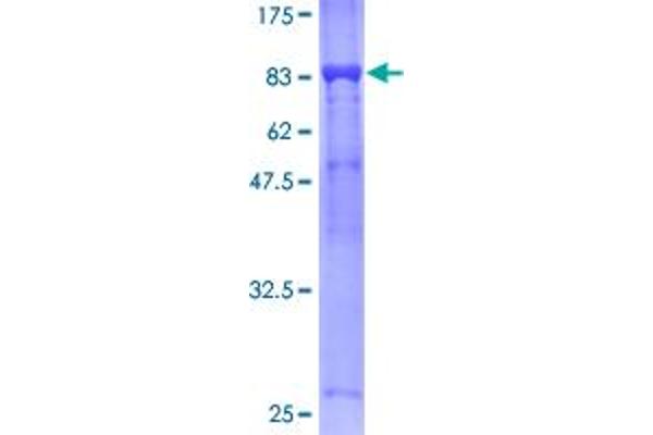 CDC16 Protein (AA 1-620) (GST tag)