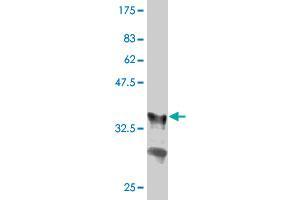 Western Blot detection against Immunogen (36. (GRB10 抗体  (AA 61-150))