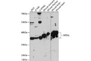 Western blot analysis of extracts of various cell lines, using GPD1L antibody (ABIN7267460) at 1:3000 dilution. (GPD1L 抗体  (AA 1-351))
