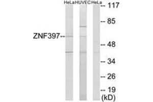 Western blot analysis of extracts from HeLa/HuvEc cells, using ZNF397 Antibody. (ZNF397 抗体  (AA 10-59))