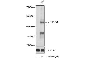 Western blot analysis of extracts of Jurkat cells, using Phospho-ELK1-S383 antibody (ABIN3019475, ABIN3019476, ABIN3019477 and ABIN6225392) at 1:1000 dilution. (ELK1 抗体  (pSer383))