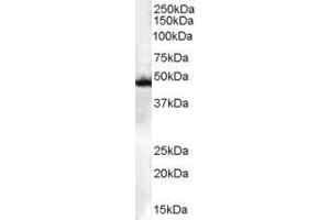 Western Blotting (WB) image for anti-C-Src tyrosine Kinase (CSK) (C-Term) antibody (ABIN184606)