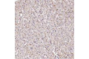 Immunohistochemical staining of human liver with TCHP polyclonal antibody  shows distinct membranous positivity in hepatocytes at 1:1000-1:2500 dilution. (TCHP 抗体)