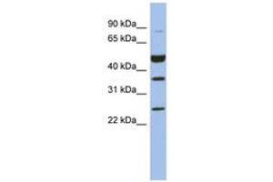 Image no. 1 for anti-Melanoma Antigen Family B, 3 (MAGEB3) (AA 35-84) antibody (ABIN6744053) (MAGEB3 抗体  (AA 35-84))