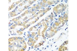 Immunohistochemistry of paraffin-embedded Human stomach using MSRB2 Polyclonal Antibody at dilution of 1:100 (40x lens). (MSRB2 抗体)