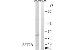 Western Blotting (WB) image for anti-Vesicle Transport Protein SFT2B (SFT2B) (Internal Region) antibody (ABIN1852378) (Vesicle Transport Protein SFT2B (SFT2B) (Internal Region) 抗体)