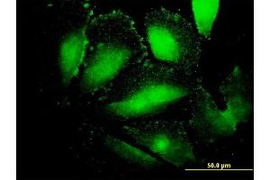 Immunofluorescence of monoclonal antibody to AFP on HepG2 cell. (alpha Fetoprotein 抗体  (AA 500-609))