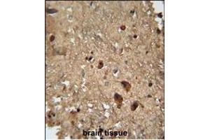 RAN antibody (Center) (ABIN652226 and ABIN2840946) immunohistochemistry analysis in formalin fixed and paraffin embedded human brain tissue followed by peroxidase conjugation of the secondary antibody and DAB staining. (RAN 抗体  (AA 112-140))