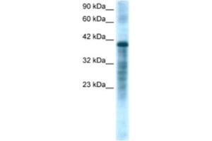 Western Blotting (WB) image for anti-Proteasome (Prosome, Macropain) 26S Subunit, ATPase, 3 (PSMC3) antibody (ABIN2460617) (PSMC3 抗体)