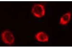 ABIN6279649 staining Hela cells by IF/ICC. (PEX5 抗体  (Internal Region))