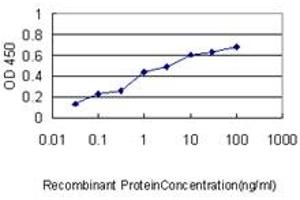 Detection limit for recombinant GST tagged ERBB2IP is approximately 0. (ERBB2IP 抗体  (AA 1272-1371))