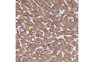 Immunohistochemical staining of human liver with LOC728597 polyclonal antibody ( Cat # PAB28327 ) shows strong cytoplasmic positivity in hepatocytes at 1:200 - 1:500 dilution. (DCDC2C 抗体)