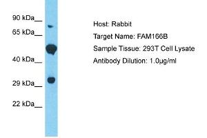 Host: Rabbit Target Name: FAM166B Sample Tissue: Human 293T Whole Cell Antibody Dilution: 1ug/ml (FAM166B 抗体  (Middle Region))