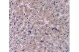 IHC-P analysis of liver tissue, with DAB staining. (RALBP1 抗体  (AA 192-380))