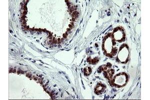 Image no. 2 for anti-Cytidine Monophosphate (UMP-CMP) Kinase 1, Cytosolic (CMPK1) antibody (ABIN1497544) (Cytidine Monophosphate (UMP-CMP) Kinase 1, Cytosolic (CMPK1) 抗体)