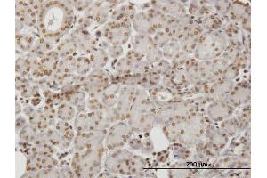 Immunoperoxidase of monoclonal antibody to HIPK1 on formalin-fixed paraffin-embedded human salivary gland. (HIPK1 抗体  (AA 330-430))