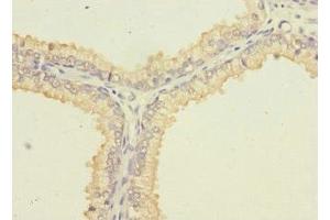 Immunohistochemistry (IHC) image for anti-Solute Carrier Family 6 (Neutral Amino Acid Transporter), Member 15 (SLC6A15) (AA 357-452) antibody (ABIN7169984)