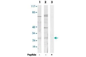 Western blot analysis of extracts from HUVEC cells (Lane 1 and lane 3) and COLO 205 cells (Lane 2), using SIX6 polyclonal antibody . (SIX Homeobox 6 抗体)
