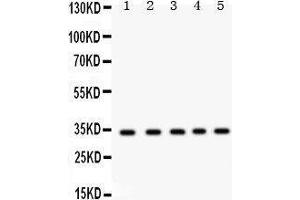 Western Blotting (WB) image for anti-Estrogen Receptor Binding Site Associated, Antigen, 9 (EBAG9) (AA 31-213) antibody (ABIN3043569) (RCAS1 抗体  (AA 31-213))