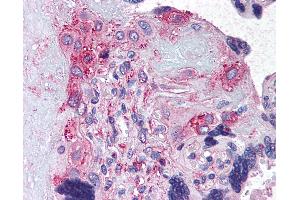 Anti-ADAMTS5 antibody IHC of human placenta. (ADAMTS5 抗体  (Internal Region))