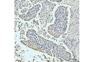 IHC analysis of GRPEL1 using anti-GRPEL1 antibody (ABIN7602643). (GRPEL1 抗体  (AA 90-217))