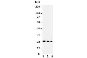 Western blot testing of BAFF antibody and Lane 1:  recombinant human protein 10ng (BAFF 抗体  (AA 265-285))
