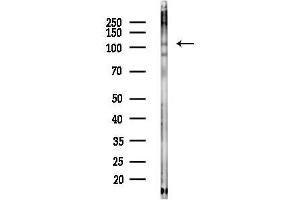Western blot analysis of lysates from HepG2 cells(heat-shock,45 min treatment), using Phospho-IRE1 (Ser724) Antibody at 1/1000 dilution.