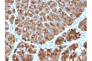 Immunohistochemistry (IHC) image for anti-Mucin 1 (MUC1) antibody (ABIN6940113)
