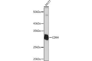 Western blot analysis of extracts of MCF7 cells, using CDK4 Rabbit mAb  at 1:1000 dilution. (CDK4 抗体)