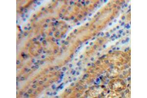 IHC-P analysis of kidney tissue, with DAB staining. (Tyrosine Hydroxylase 抗体  (AA 34-301))