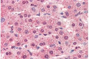 Human Liver (formalin-fixed, paraffin-embedded) stained with CTSL1 antibody ABIN364356 at 5 ug/ml followed by biotinylated anti-mouse IgG secondary antibody ABIN481714, alkaline phosphatase-streptavidin and chromogen. (Cathepsin L 抗体  (AA 114-333))