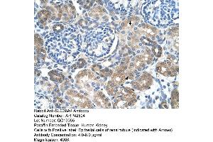 Immunohistochemistry (IHC) image for anti-Solute Carrier Family 38 Member 4 (SLC38A4) (Middle Region) antibody (ABIN2775452) (SLC38A4 抗体  (Middle Region))