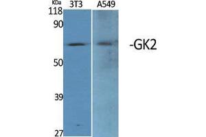 Western Blot (WB) analysis of specific cells using GK2 Polyclonal Antibody. (GK2 抗体  (Internal Region))