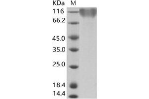 Epstein-Barr Virus Membrane Antigen gp350 (EBV gp350) protein (His tag)