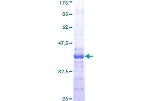Image no. 1 for Nemo-Like Kinase (NLK) (AA 416-515) protein (GST tag) (ABIN1312658) (Nemo-Like Kinase Protein (NLK) (AA 416-515) (GST tag))