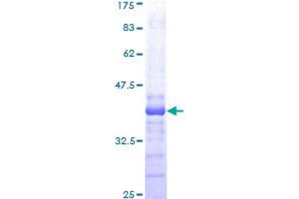 Nemo-Like Kinase Protein (NLK) (AA 416-515) (GST tag)