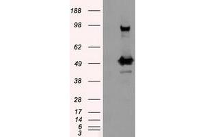 Image no. 10 for anti-Proteasome (Prosome, Macropain) 26S Subunit, ATPase, 3 (PSMC3) antibody (ABIN1501335)