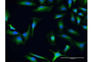Immunofluorescence of purified MaxPab antibody to CHD9 on HeLa cell. (CHD9 抗体  (AA 1-119))