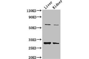 Western Blot Positive WB detected in: Mouse liver tissue, Mouse kidney tissue All lanes: PANK2 antibody at 3. (PANK2 抗体  (AA 437-490))