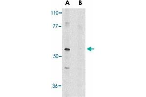 Western blot analysis of Ripk3 in mouse NIH/3T3 whole cell lysate in the absence (A) or presence (B) of blocking peptide with Ripk3 polyclonal antibody  at 1 ug/mL . (RIPK3 抗体  (AA 473-486))