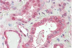 ABIN768583 (5µg/ml) staining of paraffin embedded Human Kidney. (NOX1 抗体  (Internal Region))