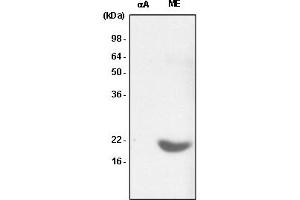 Western Blotting (WB) image for anti-Crystallin, alpha B (CRYAB) antibody (ABIN165394)