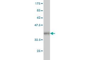 Western Blot detection against Immunogen (36. (alpha-Mannosidase II 抗体  (AA 1045-1144))