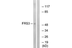 Western blot analysis of extracts from COS7 cells, using FRS3 Antibody. (FRS3 抗体  (AA 191-240))
